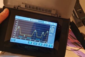 Profometer: Betondeckung Ergebnis